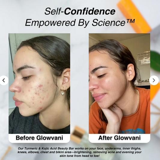 Soliq™ : Turmeric & Kojic Acid Soap
